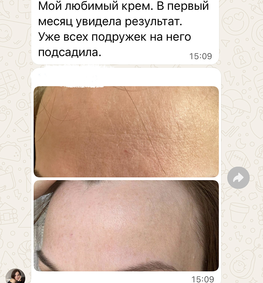 Фото отзывы